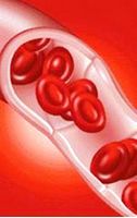 Анемии возникающие в результате уменьшения образования гемоглобина